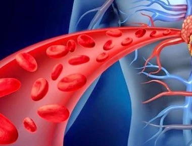 Αυτές είναι οι δέκα τροφές που «καθαρίζουν» τις αρτηρίες